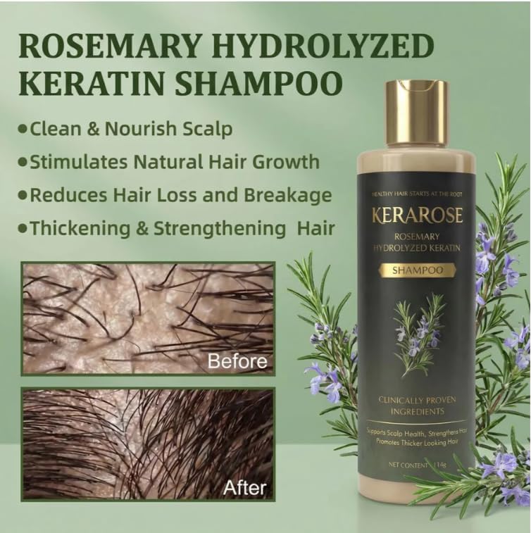 Kerarose Rosemary Shampoo For Hair Growth (Buy 1 Get 1 Free)