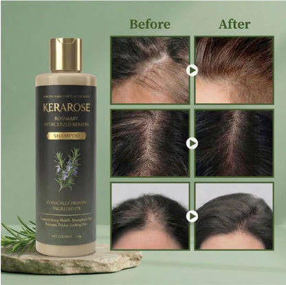 Kerarose Rosemary Shampoo For Hair Growth (Buy 1 Get 1 Free)
